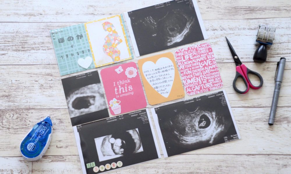 プレママのための 愛する赤ちゃんのエコー写真をベビーアルバムにまとめる方法 出産前のベビーアルバム作り方 写真整理術 スクラップブッキング101
